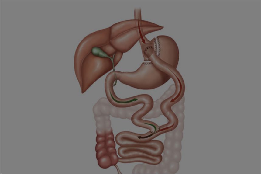 Cirurgia Robótica